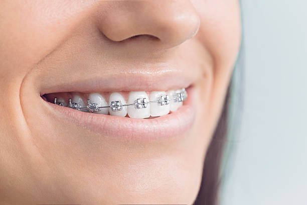 Best Full Mouth Reconstruction  in Leonville, LA